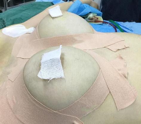 手術(shù)前的準備