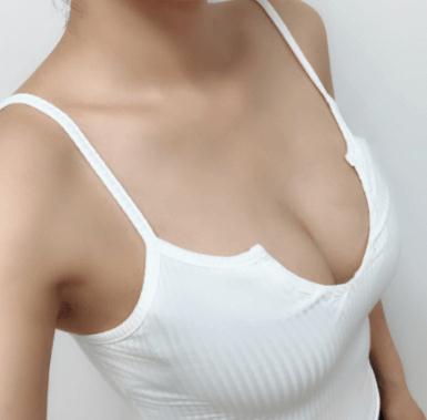 隆胸術(shù)后果