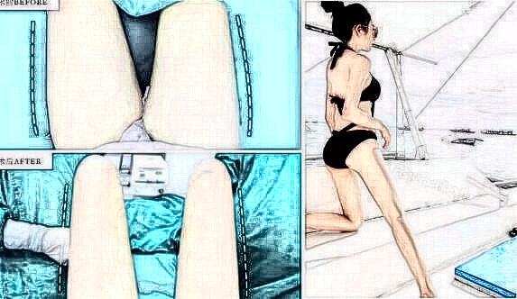 成都楊瀚城醫(yī)生的案例