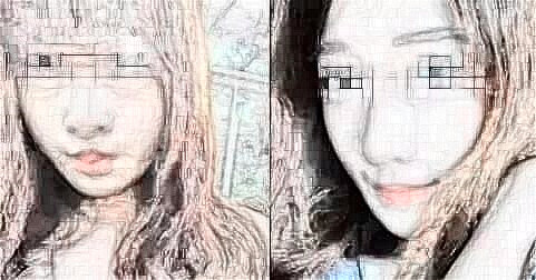 閆海廷醫(yī)生案例