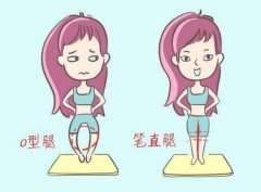 O型腿怎么矯正？據(jù)說這5種方法很靠譜！