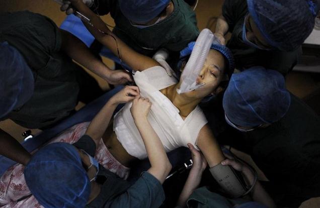 隆胸術(shù)后注意事項(xiàng)