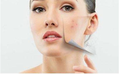 毒素在體內(nèi)蓄積