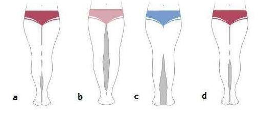 X型腿變成筆直的腿型有哪些方法？