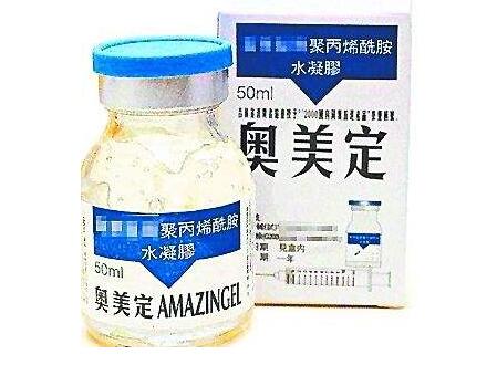 為什么玻尿酸填充臉頰多年不吸收?