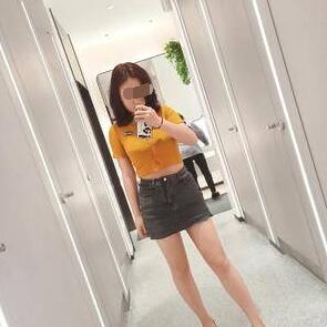 大腿吸脂手術(shù)術(shù)后兩個月