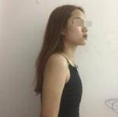 隆胸手術(shù)術(shù)前