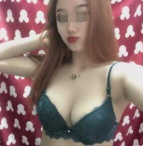 隆胸手術(shù)術(shù)后第34天