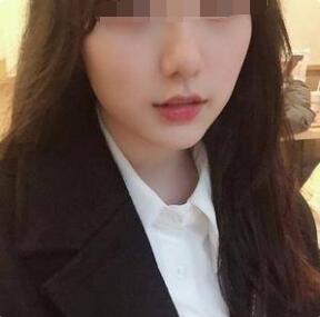 豐唇手術(shù)術(shù)后半個(gè)月