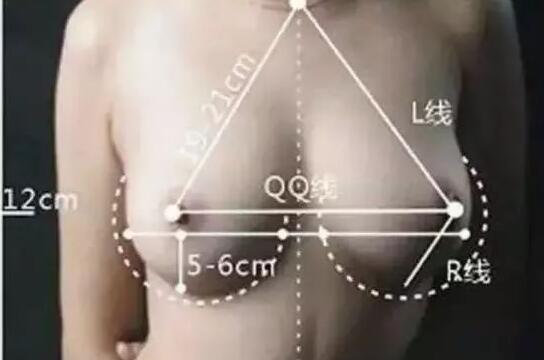 做完乳房假體植入手術(shù)之后的護(hù)理指導(dǎo)~