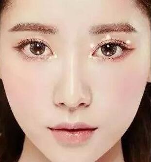 開眼角手術(shù)后的注意事項