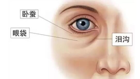 淚溝的祛除方法