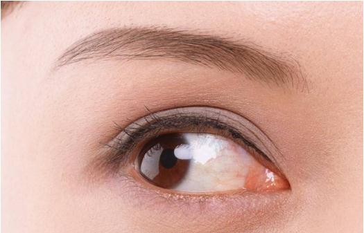 開眼角手術(shù)的風(fēng)險大嗎?