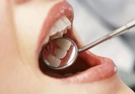 什么是牙結(jié)石？牙結(jié)石有什么危害？