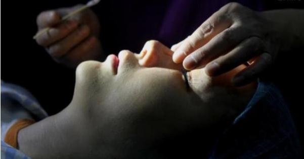 整形術(shù)后的注意事項