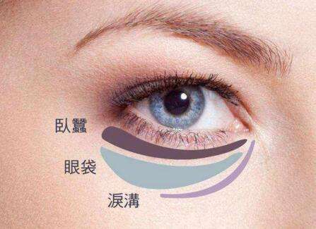 了解淚溝、臥蠶和眼袋的區(qū)別后再選擇手術方式