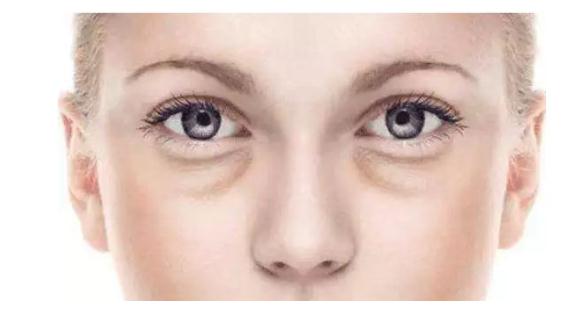 填充臥蠶的方法