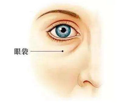 抽脂去眼袋后皮膚變松弛，有什么補救措施？