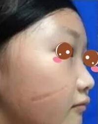 真正案例分享：