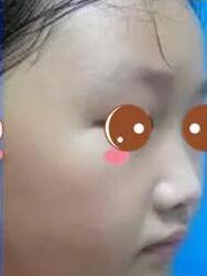 真正案例分享：