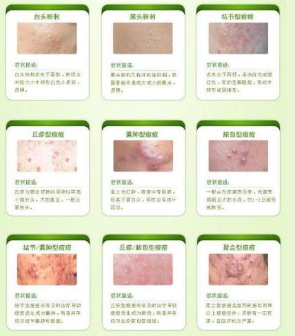 不良的作息習(xí)慣