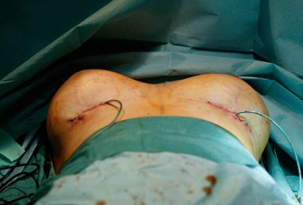 用溫和的洗面奶清洗胸部