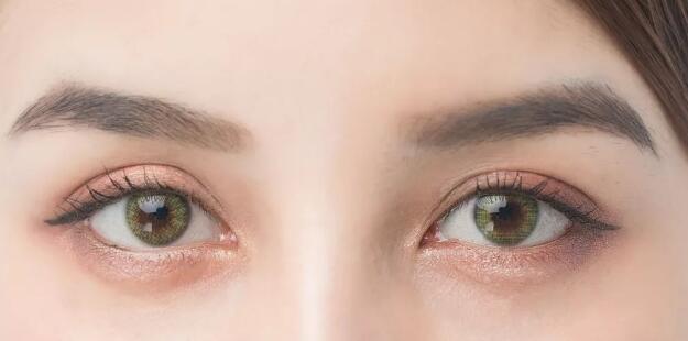 不是所有人都是適合開眼角手術(shù)！