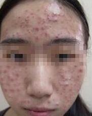 調(diào)節(jié)方法