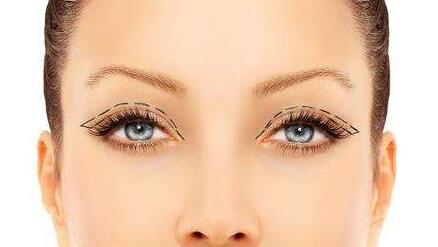 全切雙眼皮拆線之后可以化妝了嗎？