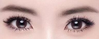 雙眼皮手術(shù)