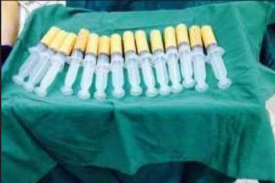 面部脂肪填充過量，按壓和吸脂可以解決這個問題嗎?