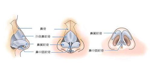 綜合性鼻整形術(shù)的一般恢復(fù)期是多久?