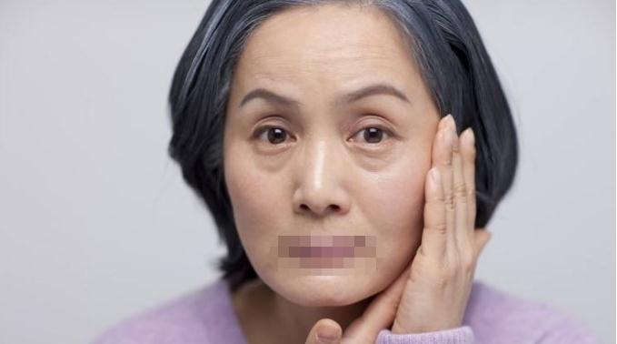 激光祛眼袋的好處