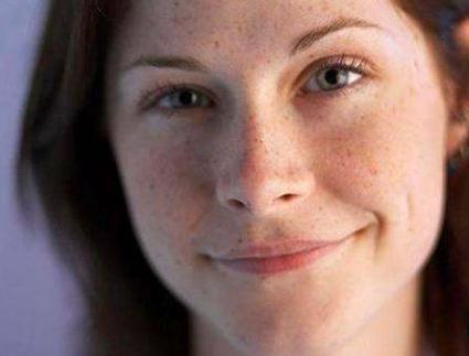 有雀斑的困擾？雀斑可以完全的祛除嗎？