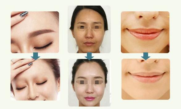 洗眉留下疤痕怎么辦？