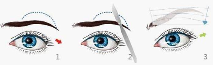 洗眉留下疤痕怎么辦？