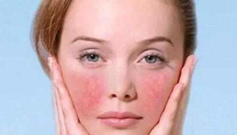 激光去除紅血絲的危害及副作用