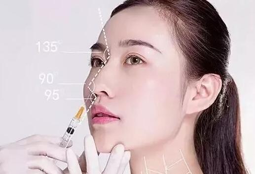 玻尿酸注射鼻頭、延長(zhǎng)鼻小柱的果