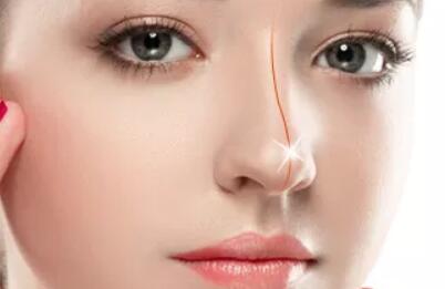 玻尿酸注射鼻頭、延長(zhǎng)鼻小柱？你可千萬(wàn)別這樣