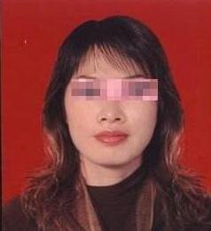 雀斑到底可以完全祛除嗎?