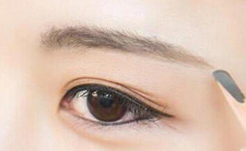 激光洗眉后留疤了怎么辦？疤痕怎么去除？