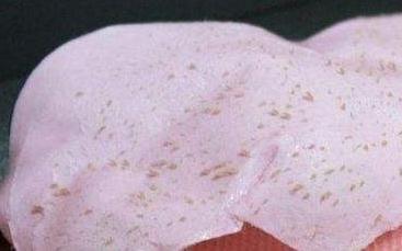 牛奶、鹽可以去除黑頭