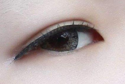 做完雙眼皮之后眼睛睜不開是怎么回事?