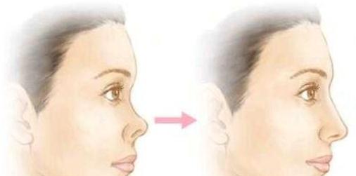 術(shù)前咨詢：