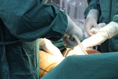 吸脂后出現(xiàn)凹凸不平怎么辦?