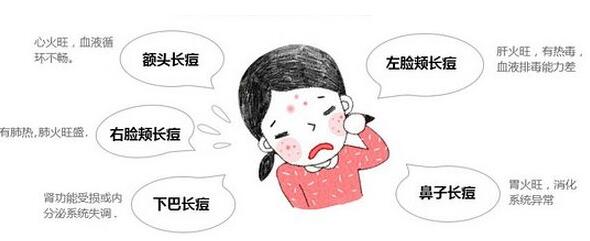 點(diǎn)陣激光祛痘原理