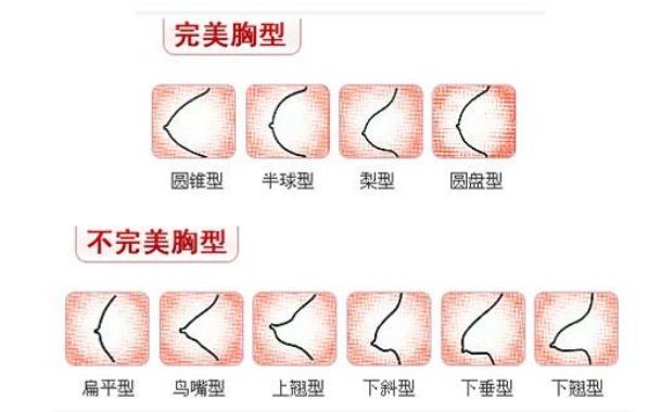 假體隆胸曼托多少錢?