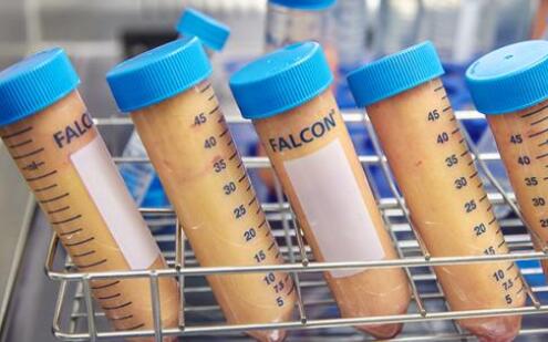 玻尿酸或自體脂肪填充那個貴?