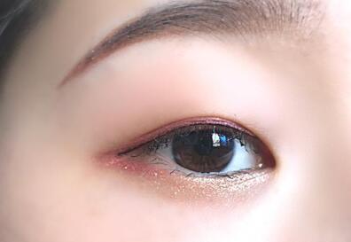 哪些癥狀說明了雙眼皮手術(shù)失敗？