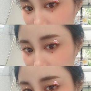  做雙眼皮手術(shù)的注意事項(xiàng)！